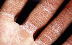 Article Image for Inside the Science of Skin Barrier Repair