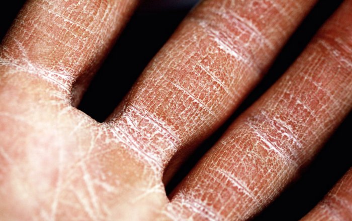 Article Image for Inside the Science of Skin Barrier Repair